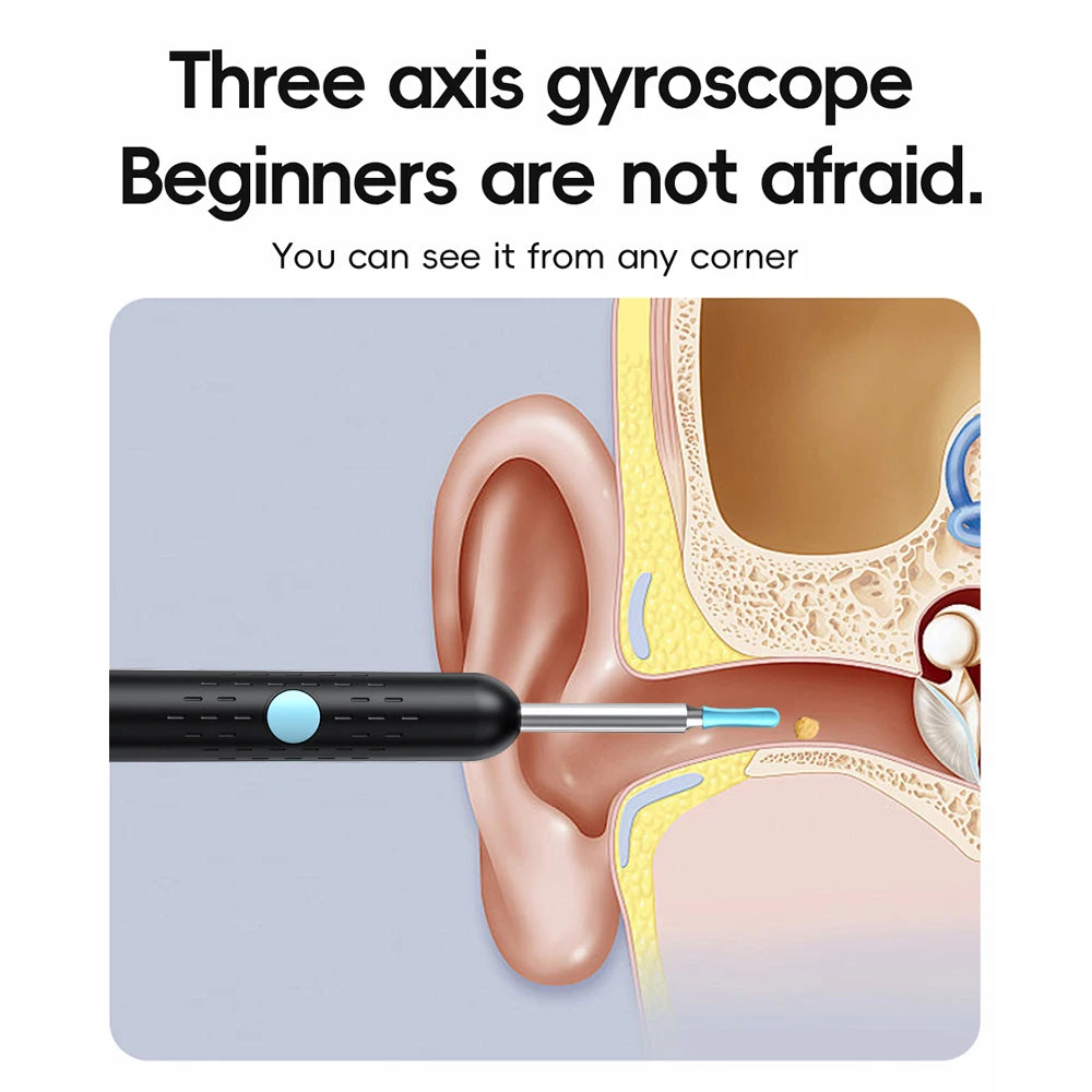 Smart Visual Ear Cleaner with Mini Camera