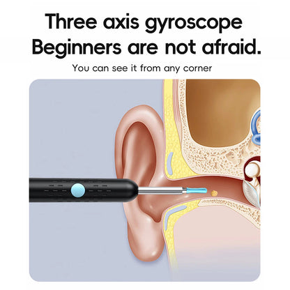 Smart Visual Ear Cleaner with Mini Camera